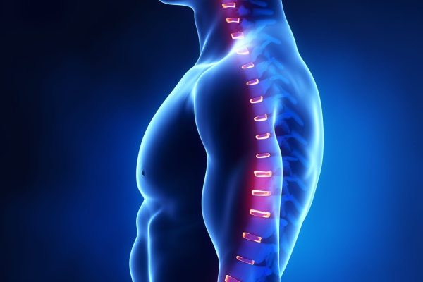 douleurs-dos-semlles-orthopédiques-1-1